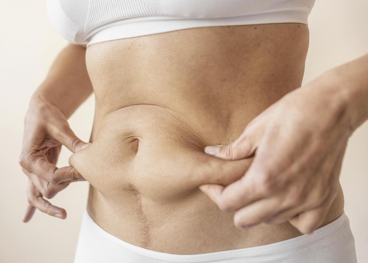 Gordura abdominal: incomodo ou problema de saúde?